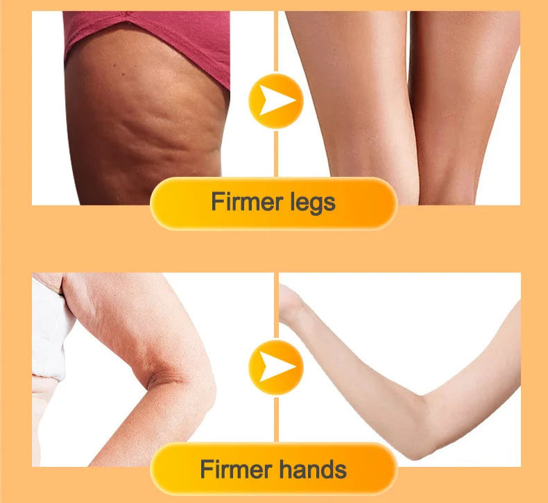 Alora - Anti Cellulite Massage Oil